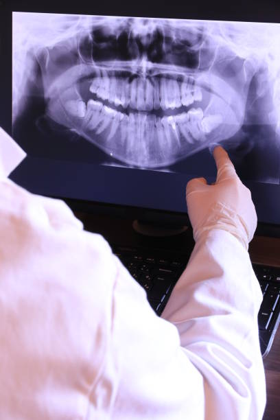 Best Emergency Root Canal Treatment in Thomasville, AL