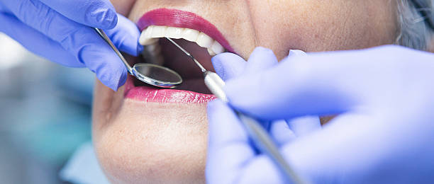 Best Emergency Dental Care for Abscessed Tooth in Thomasville, AL